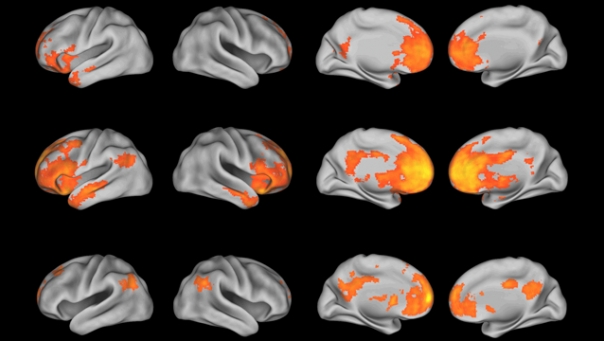 http://www.dreig.eu/caparazon/2011/04/10/cerebros-liberales-cerebros-conservadores/brain-scans-colorful/ brain scans colorful